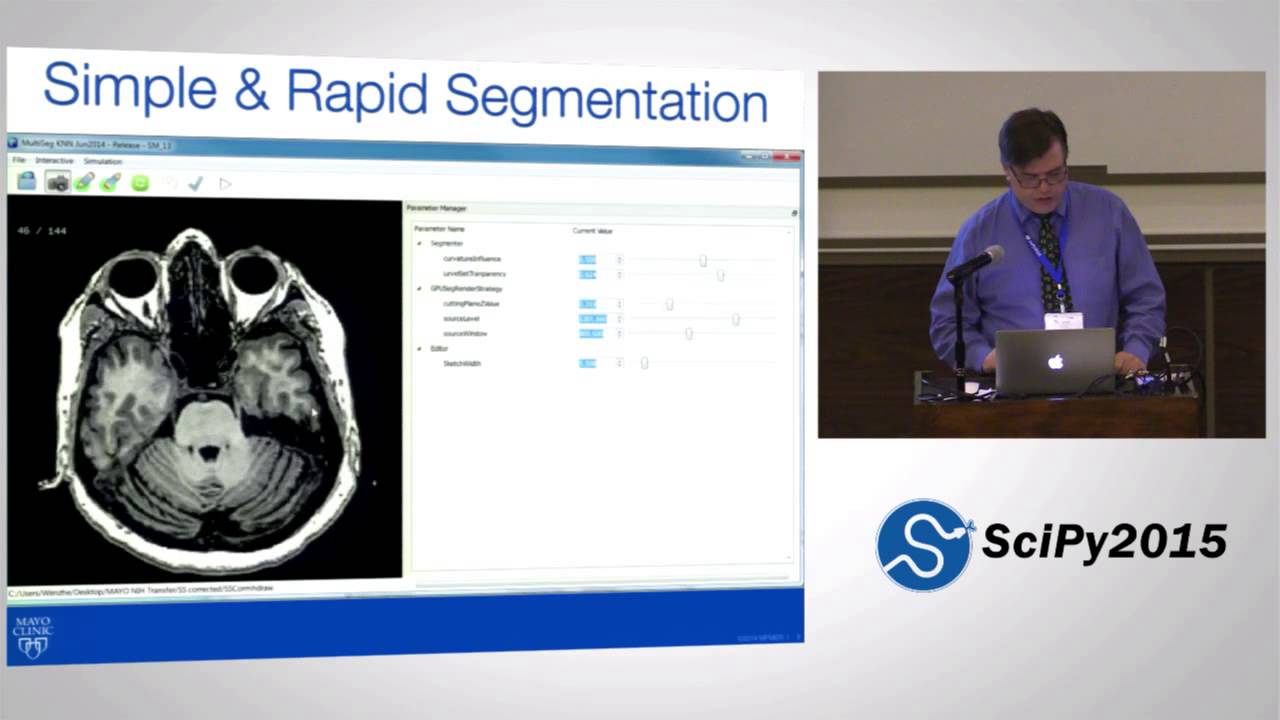 Rapid Accurate and Simple Segmentation of OBjects in Medical Images | SciPy 2015 | Ross Mitchell