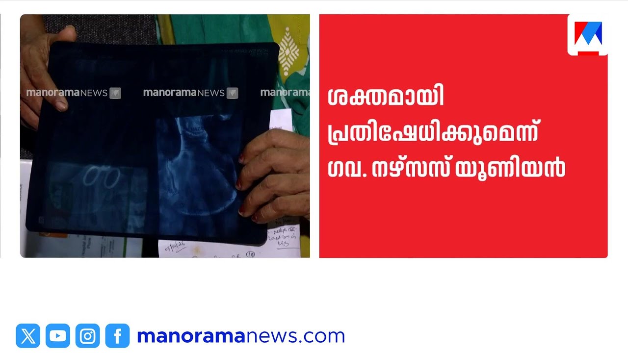 ആലപ്പുഴ മെഡിക്കൽ കോളജ് ശസ്ത്രക്രിയ പിഴവ്: ഡോക്ടറെ രക്ഷിക്കാൻ നീക്കമെന്ന് നേഴ്സുമാരുടെ സംഘടന | Nurse