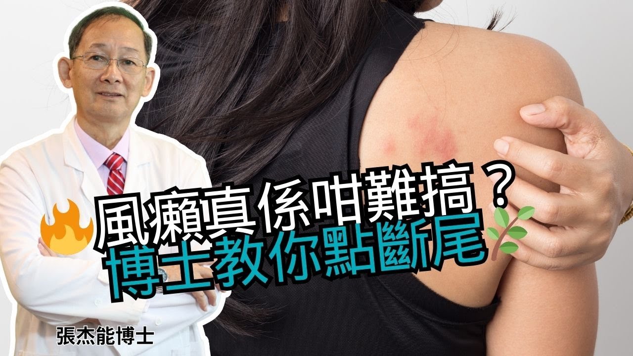 🔥皮膚癢到崩潰？風團反覆發作？👉張博士曝蕁麻疹根治秘方！ 🌿天然外洗方+內調體質，告別「風癩」不復發
