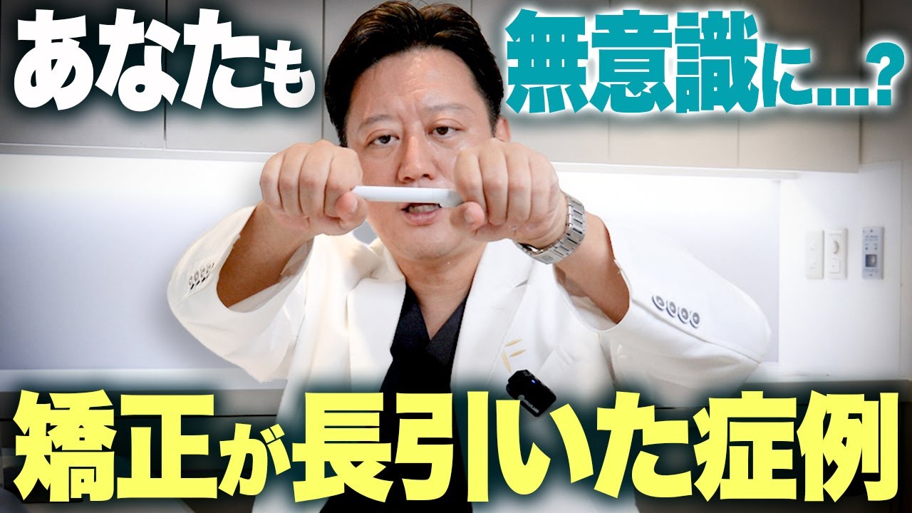 小さい歯の矯正治療！口ゴボの矯正で歯ぎしりのせいで矯正期間が延びた症例を解説します【審美歯科 歯列矯正 歯並び 矮小歯】