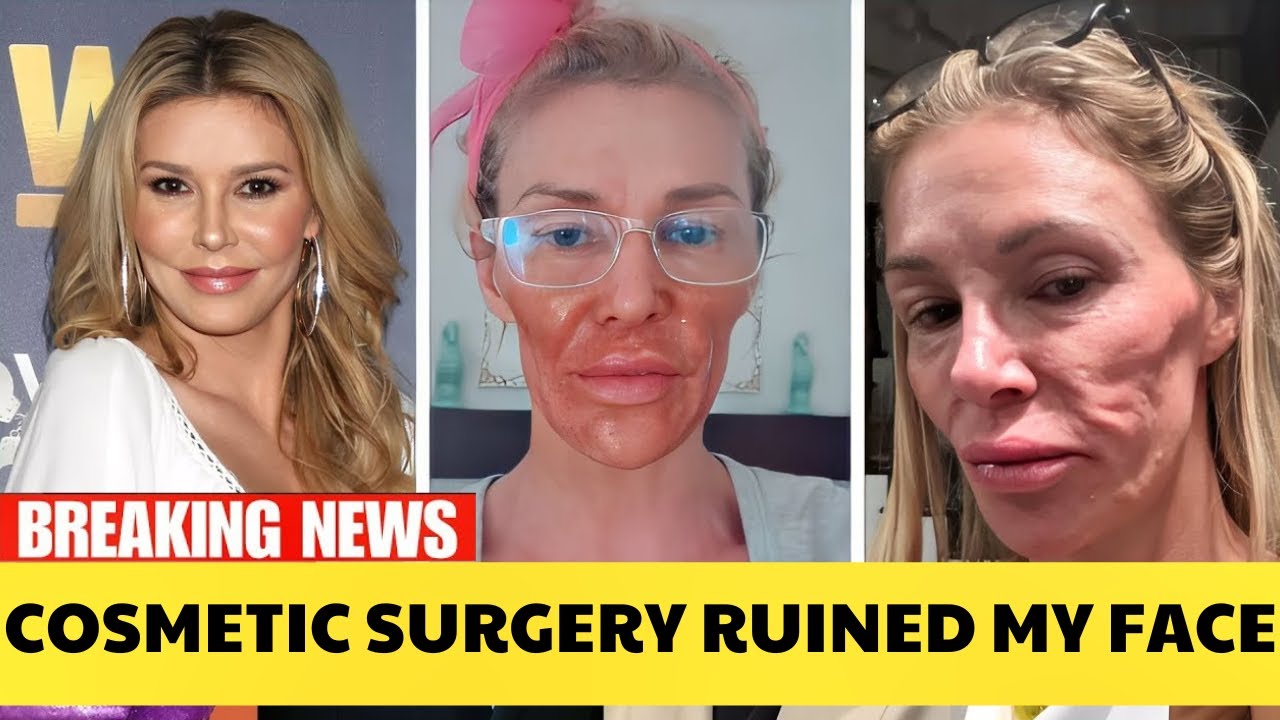 15 Plastic Surgery Disasters You Won&rsquo;t Believe Happened | Then and Now 2026