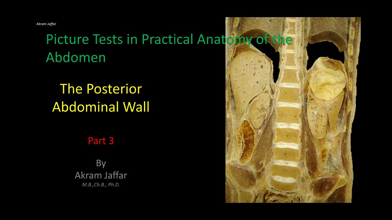 Picture Tests in Anatomy - Abdomen - Posterior Wall 3 + Anki flashcards