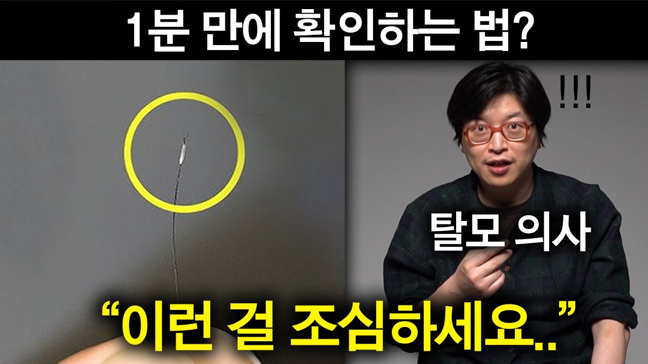 탈모의사가 말하는 이미 탈모인 사람들 특징 (의외의 사실ㄷㄷ)