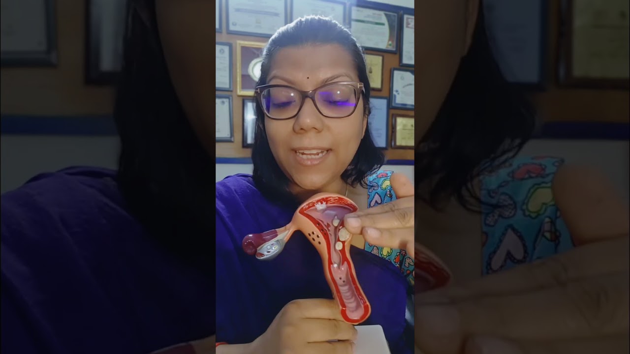 Best position to have sex to get pregnant #sexposition #pregnancytips #fertilitytreatment