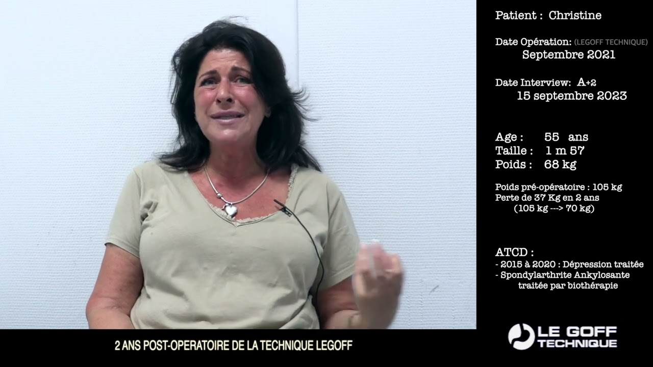 Interview Christine 11 - Conseils d'une obèse opérée depuis 2 ans par la technique Legoff