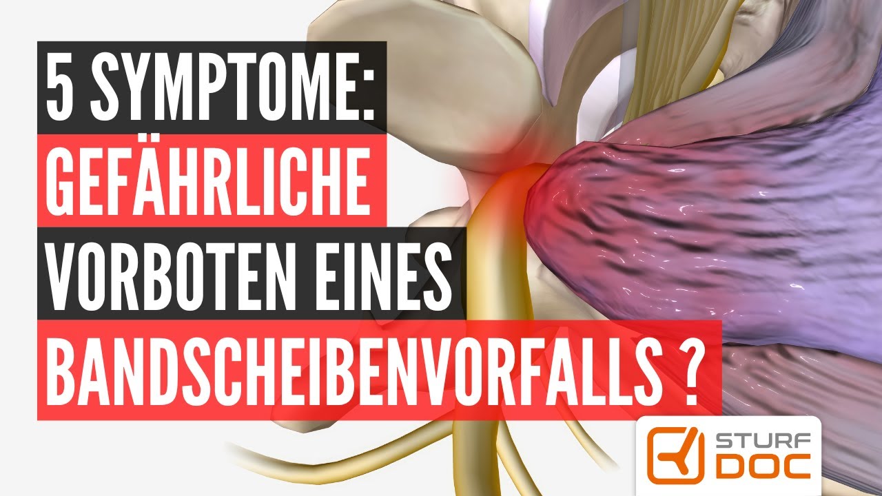 Bandscheibenvorfall - Diese 5 Symptome kündigen ihn an!