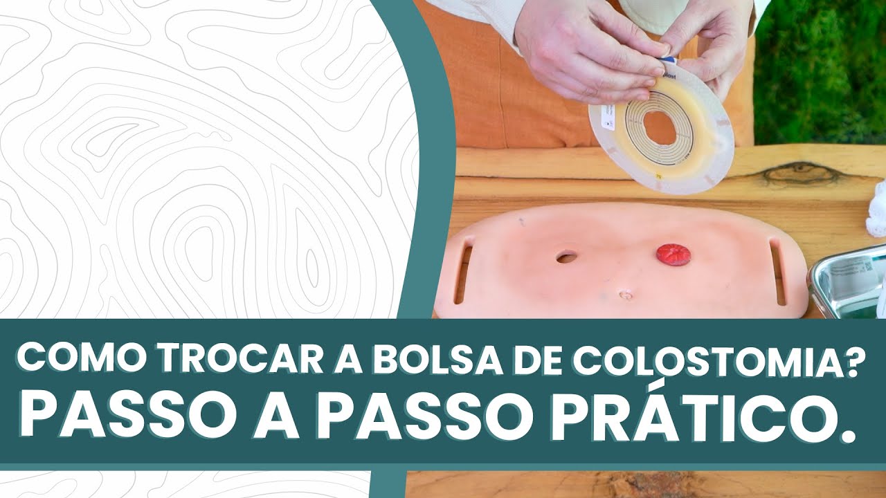 Como colocar uma bolsa de colostomia? Como trocar a bolsa de colostomia?