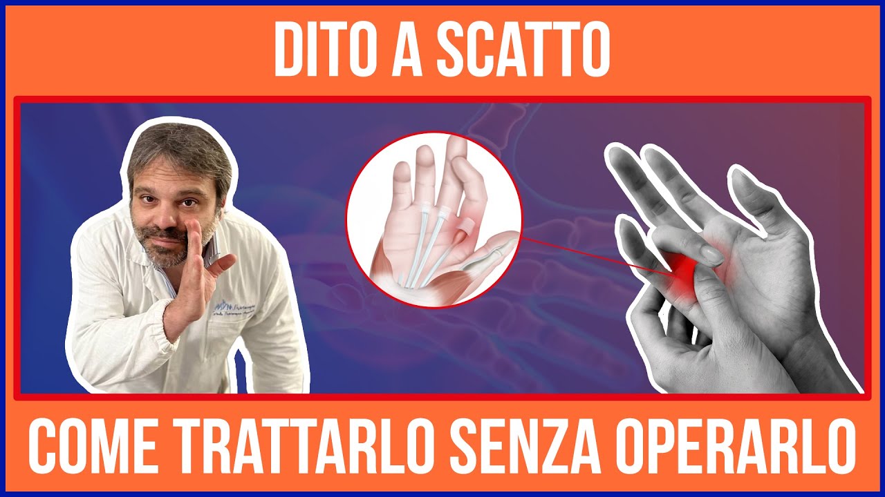 Come curare il dito a scatto senza intervento?