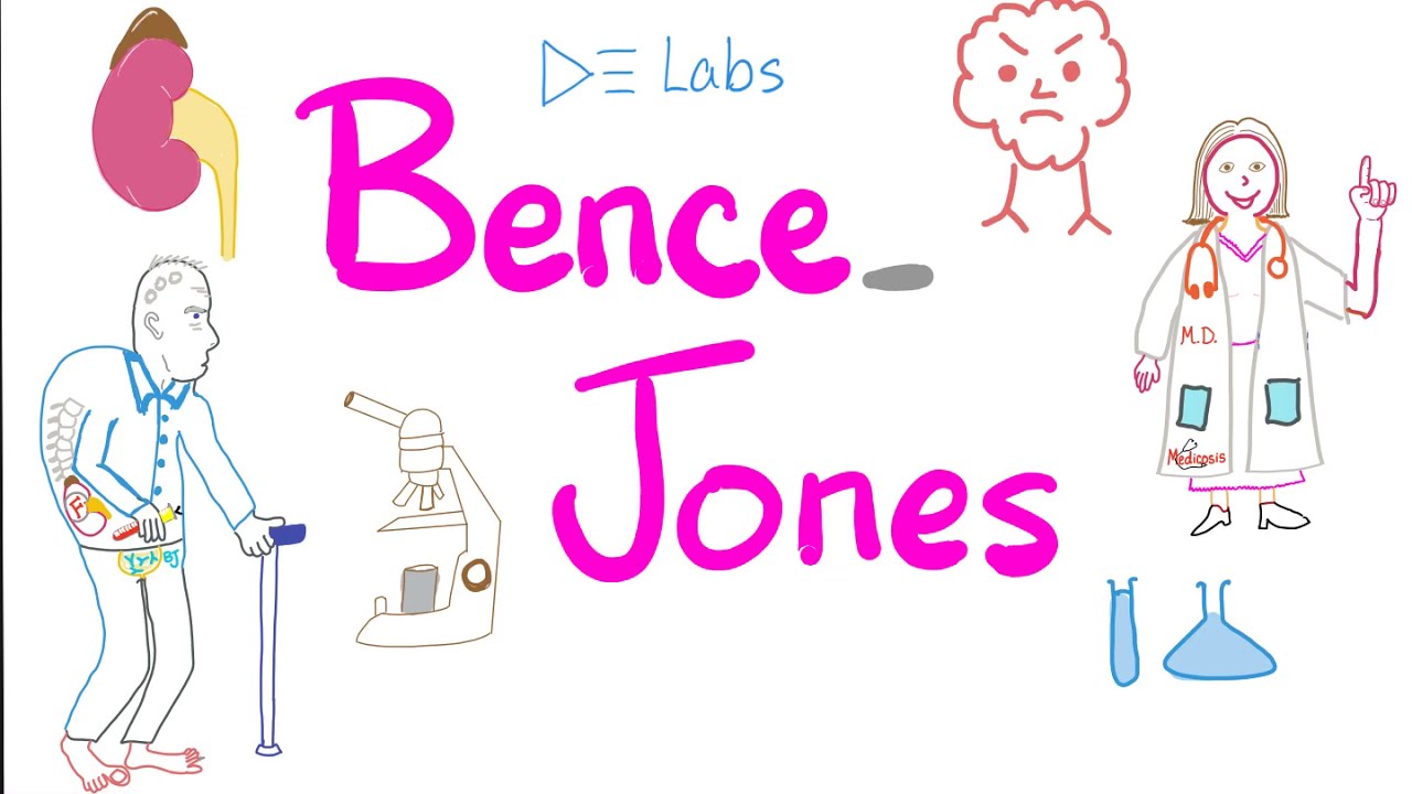 Bence Jones Proteins - Multiple Myeloma - Urine Test