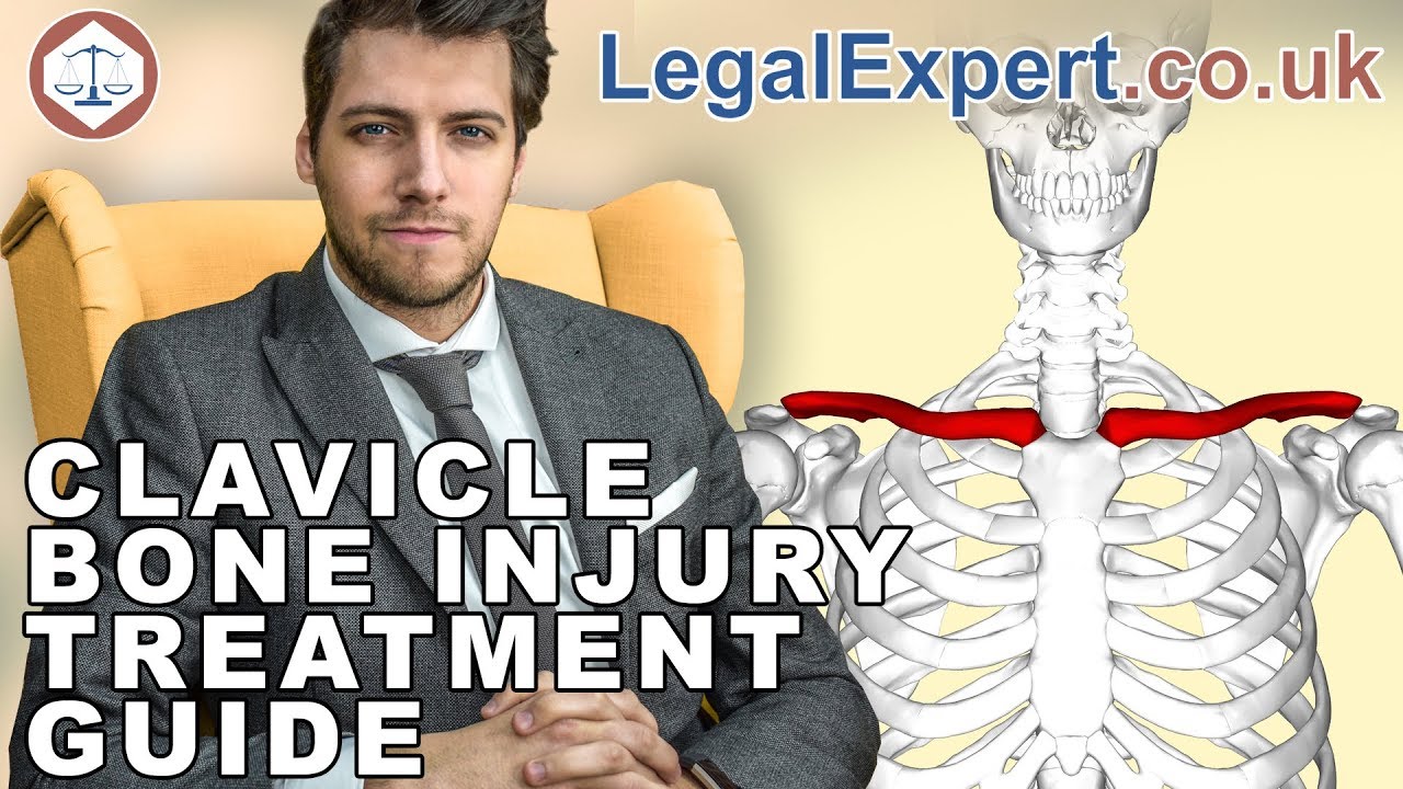 Clavicle Bone Injury Treatment Guide ( 2021 ) UK