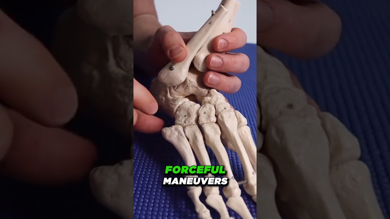 Cuboid Syndrome  [Self Care & Home Treatment, Lateral Outside Foot PAIN!]