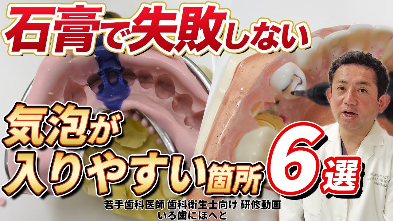 【失敗しないための石膏の知識】気泡の入りやすい箇所