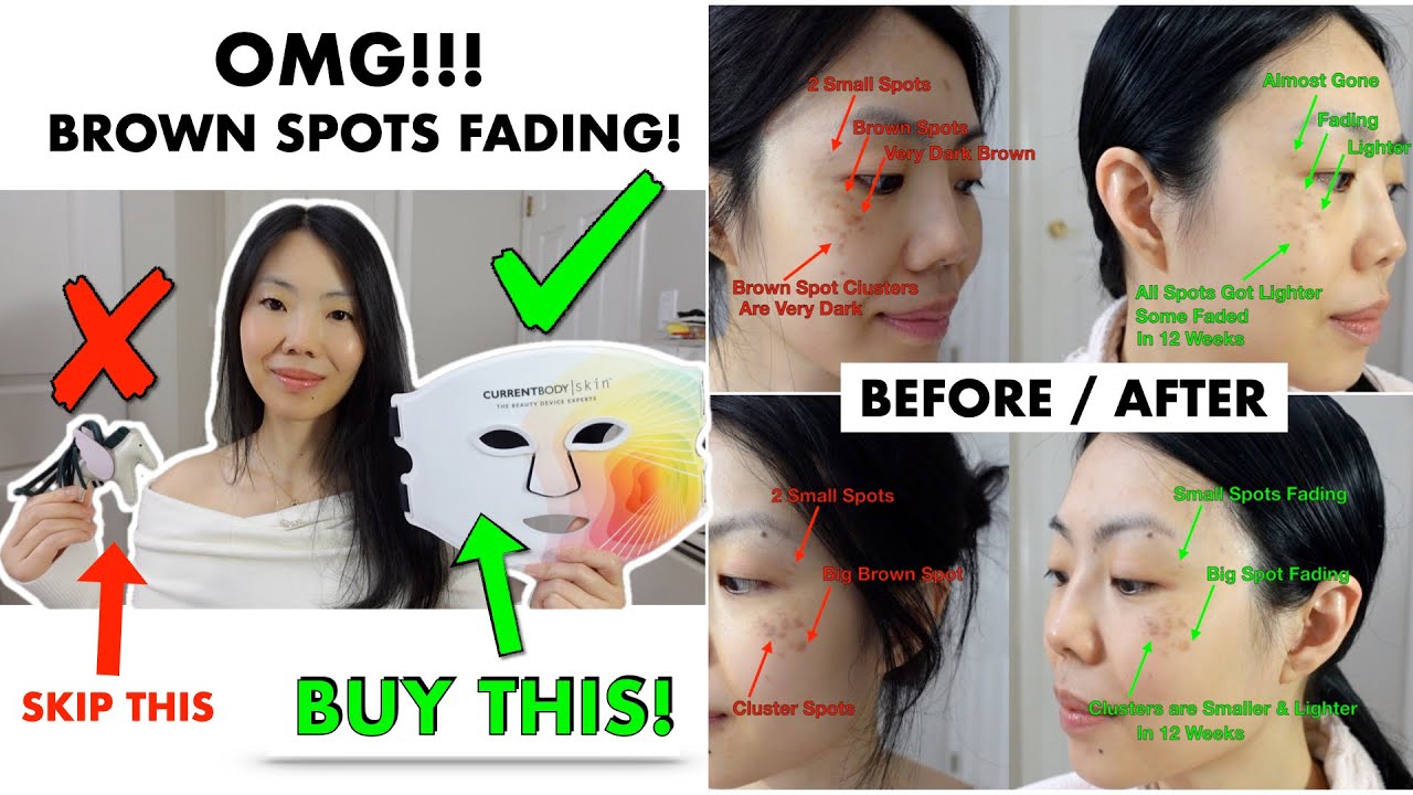 This $500 LED Mask TRANSFORMED My Skin Forever! 😱 2-Month Results | CurrentBody LED Face Mask Review