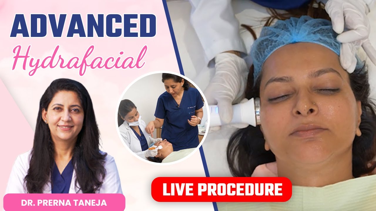 Advanced Hydrafacial Live Procedure | Advantages of Advance Hydrafacial | Clinic Eximus