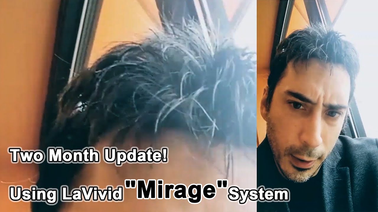 Two Month Update for Mirage Hair System | LaVivid Hair System