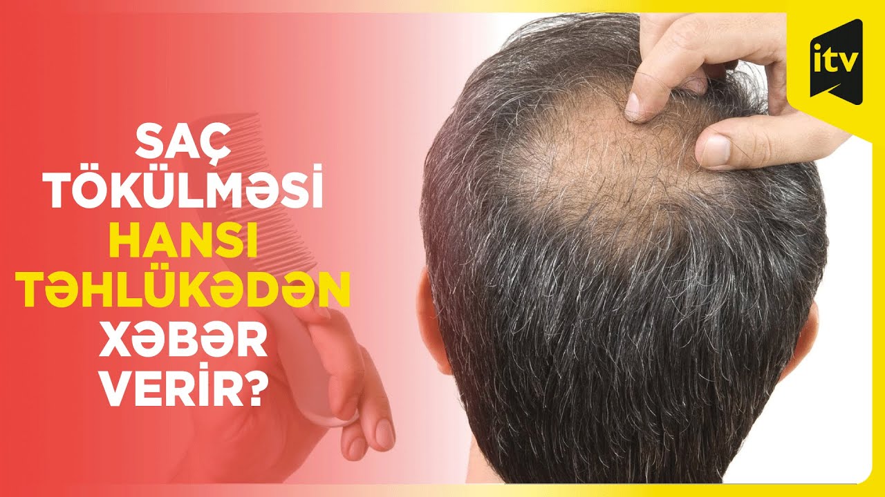 Saç tökülməsi hansı təhlükədən xəbər verir?