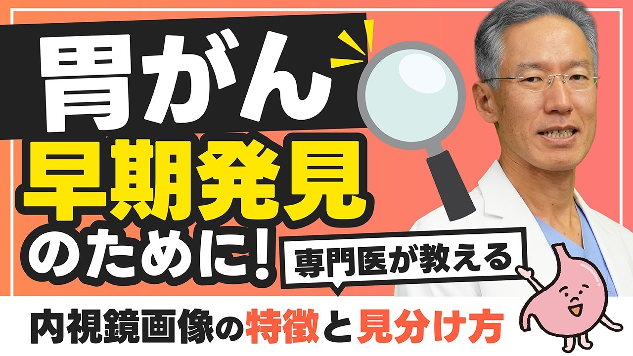 【胃がん】専門医が教える！胃カメラの内視鏡画像の特徴と見分け方