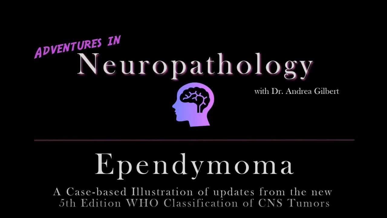 Ependymoma:   Update from the 5th Edition WHO Classification of CNS Tumors