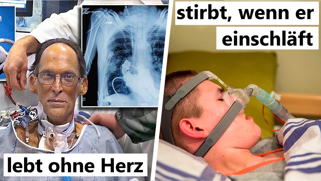 8 unglaubliche Menschen mit einmaligen Krankheiten