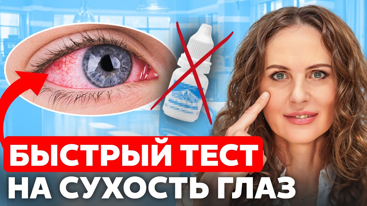 КАК избавиться от СУХОСТИ ГЛАЗ за 5 МИНУТ? ПРОВЕРЯЙ себя!