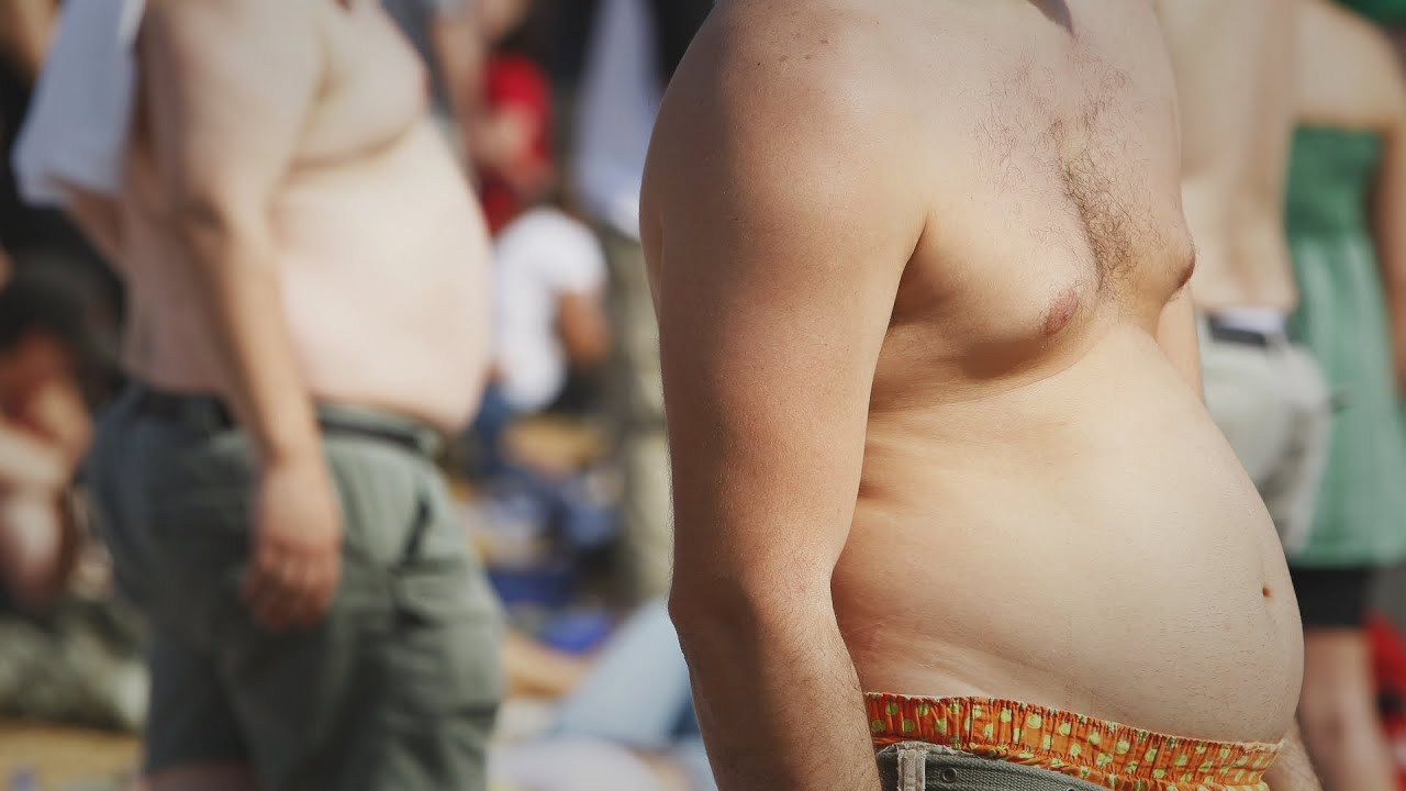 Obesity on the rise