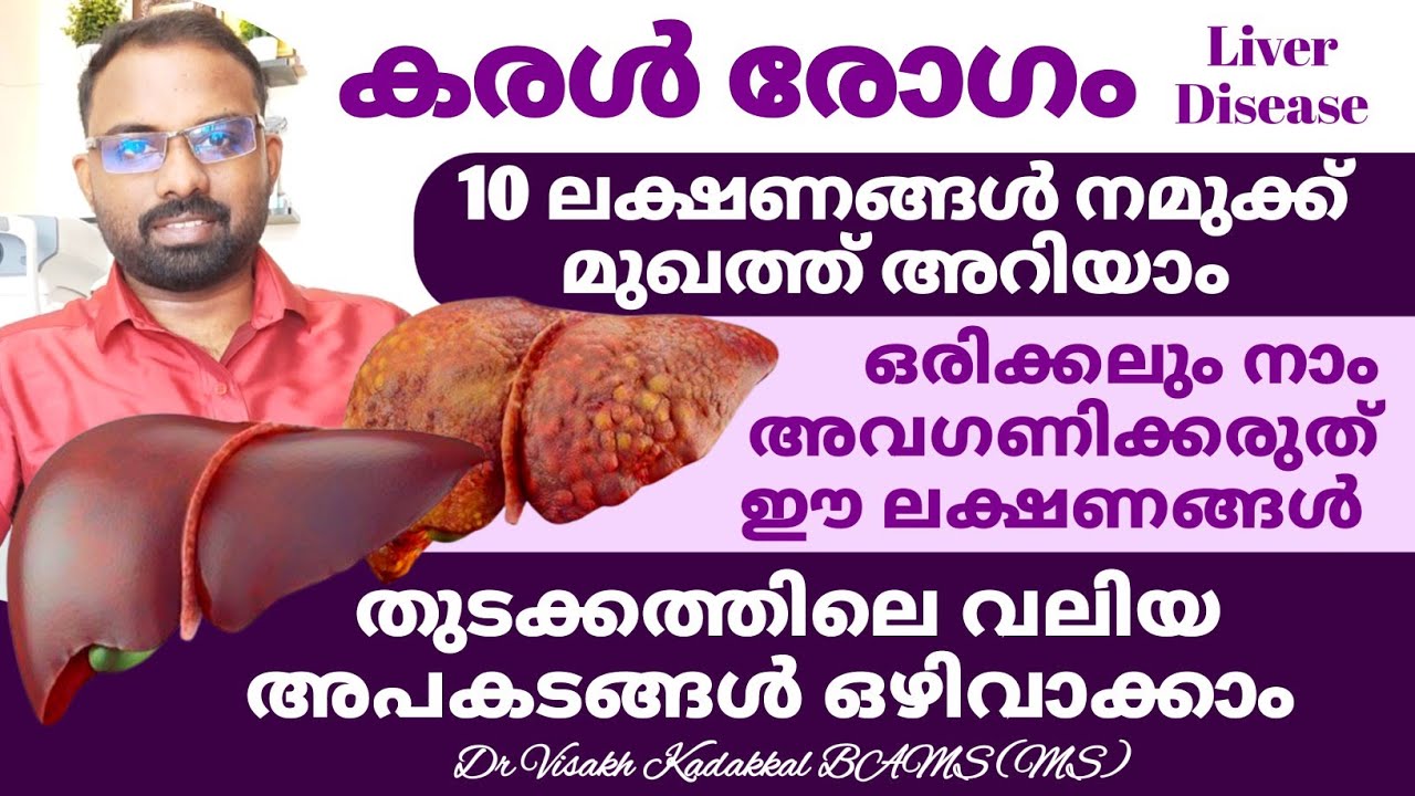 മുഖത്ത് അറിയാം കരൾ രോഗ ലക്ഷണങ്ങൾ | Early signs & symptoms of Liver Disease | Dr Visakh Kadakkal