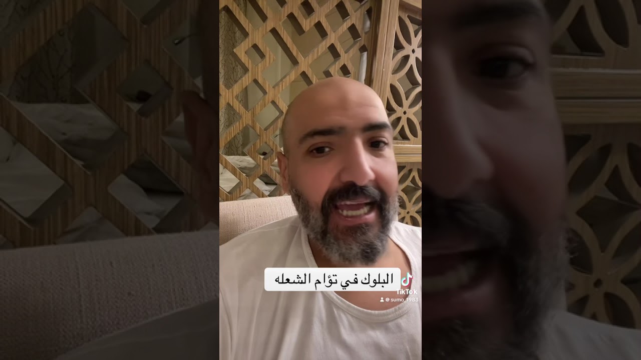 البلوك في تؤام الشعله 