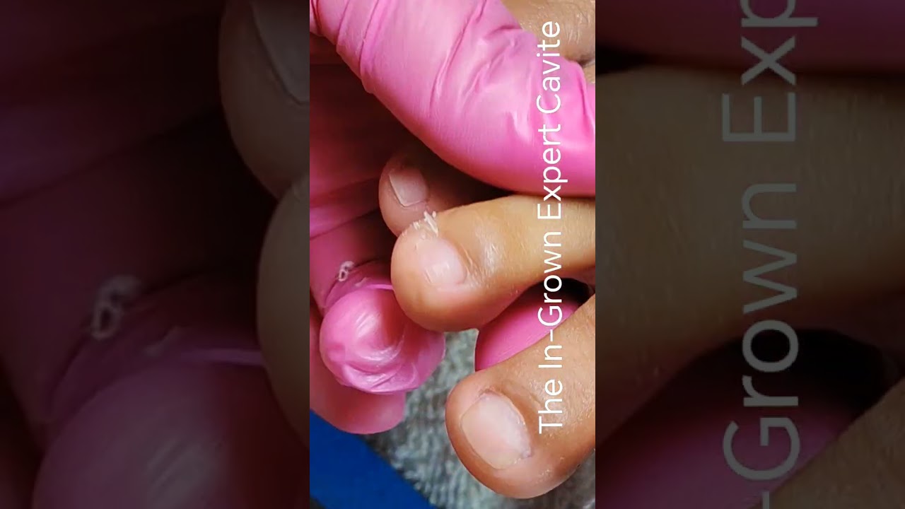 Full video pedicure and dryskin removal