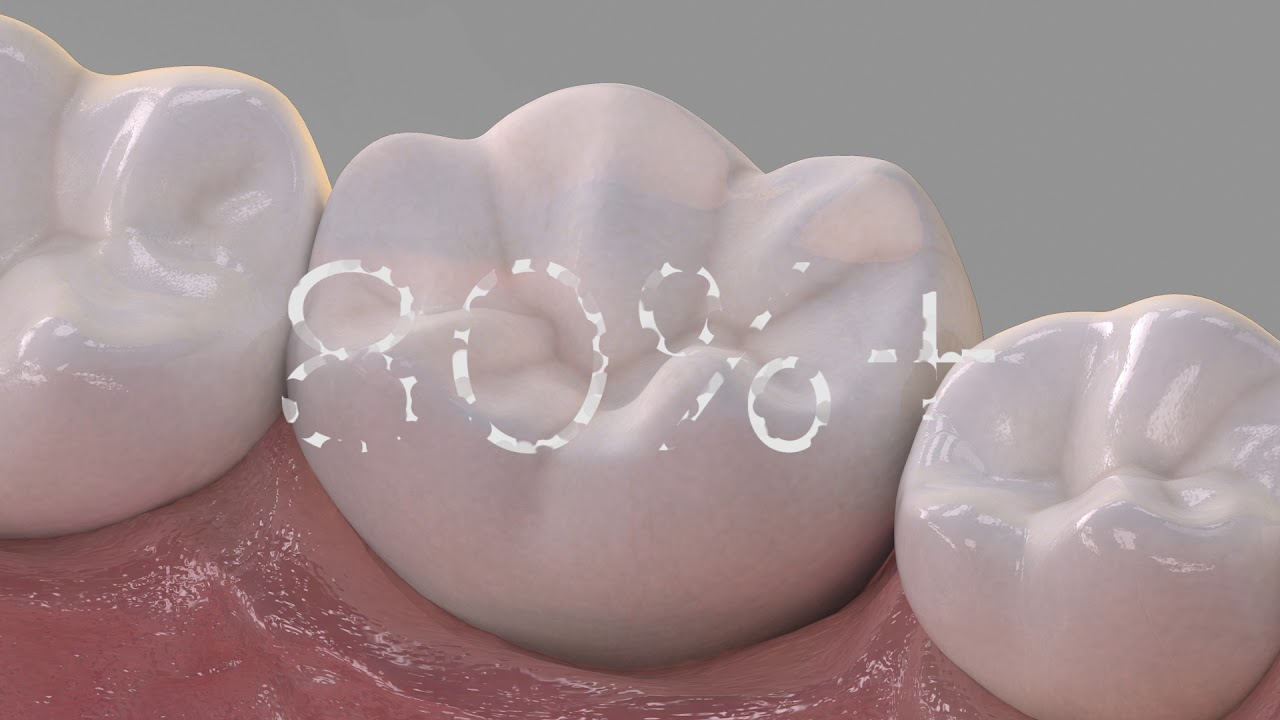 Enhance - Intro I Dentsply Sirona