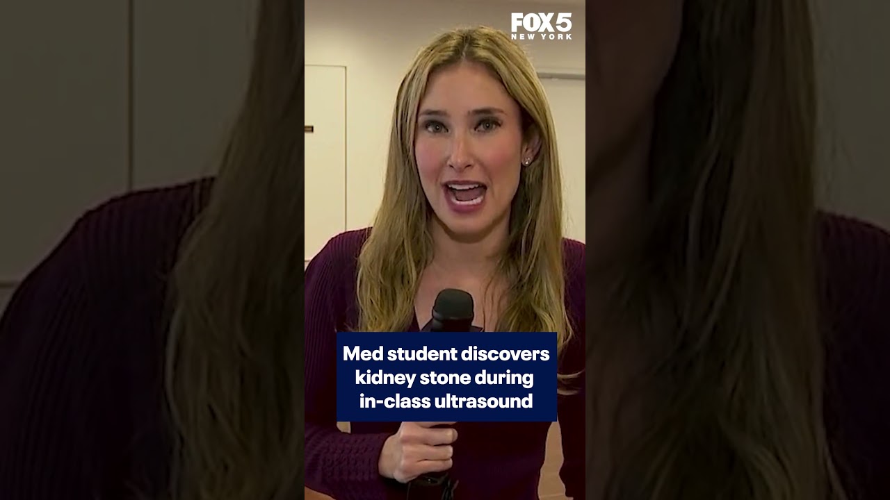 Med student discovers kidney stone during in-class ultrasound