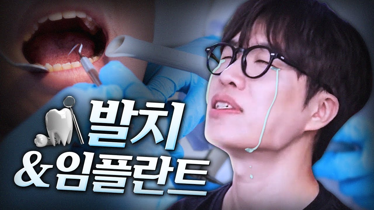 치과 썰..😭
