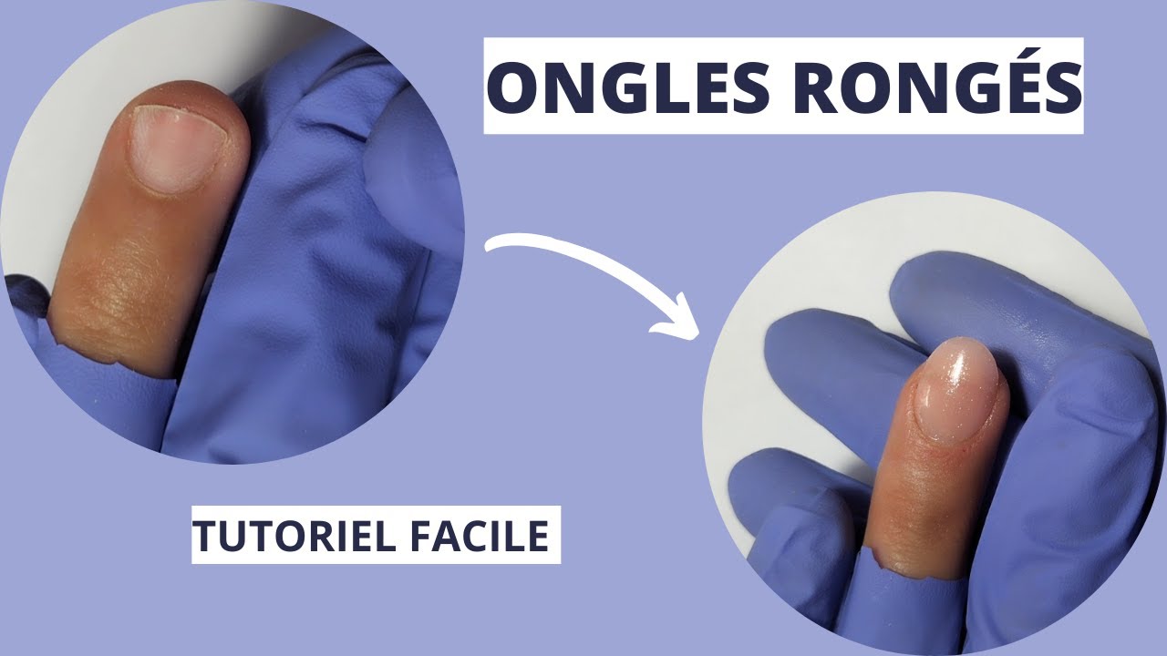 Comment faire un RALLONGEMENT au chablon sur ONGLES RONGÉS.