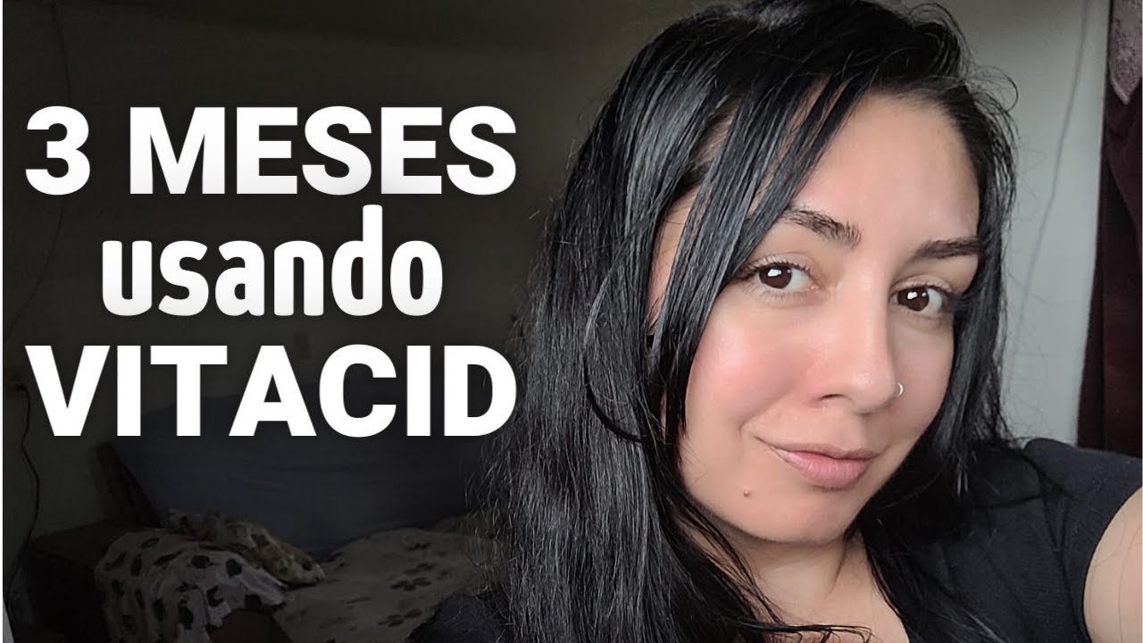 3 MESES USANDO VITACID 0,05% CREME | COMO EST&Aacute; MINHA PELE? HIDRATANTES HADA LABO FUNCIONAM MESMO?