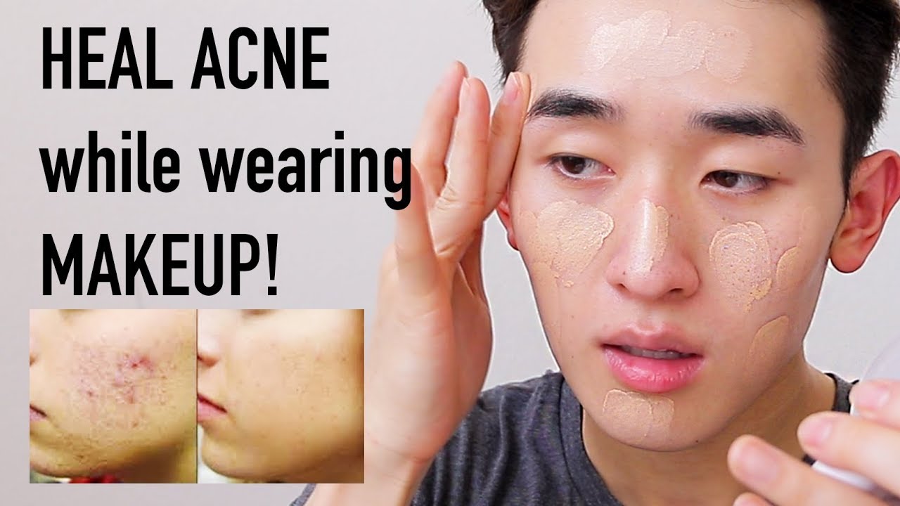 BEST CUSHION Foundations for ACNE-PRONE SKIN! | Ivan Lam
