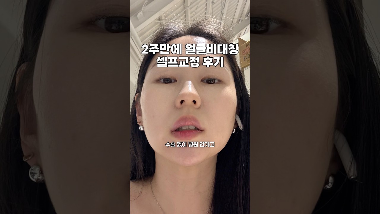 2주안에 진짜 안면비대칭 교정될까?🧐