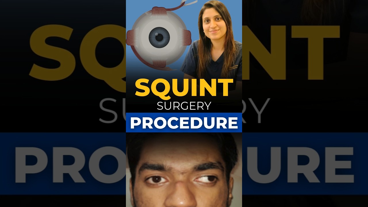 Squint Surgery Procedure: Step-by-Step Explained!