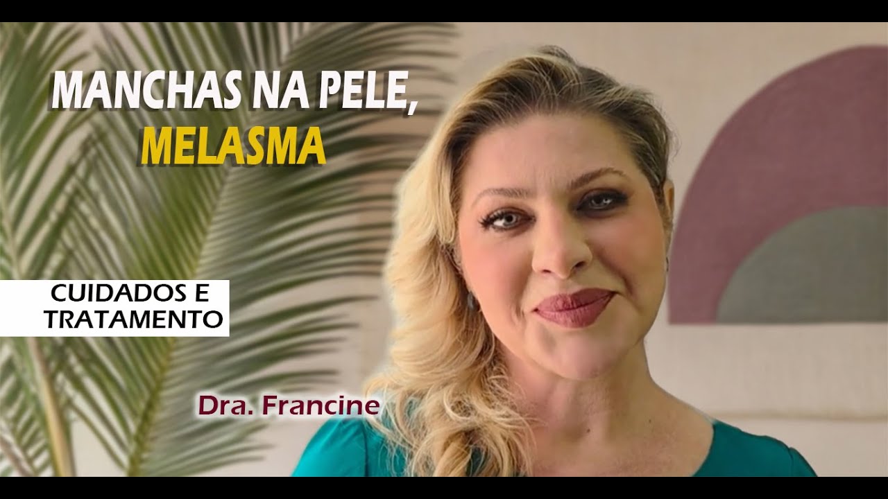 Manchas na pele (melasma). Como prevenir, cuidar e tratar