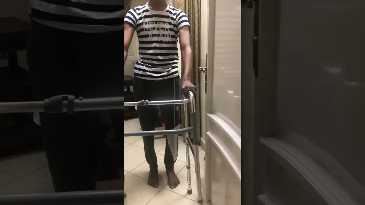 حاله شلل نصفي يمشي بمفرده بدون جباير او دعامات خارجية مع د / رانيا السيد عبد العليم