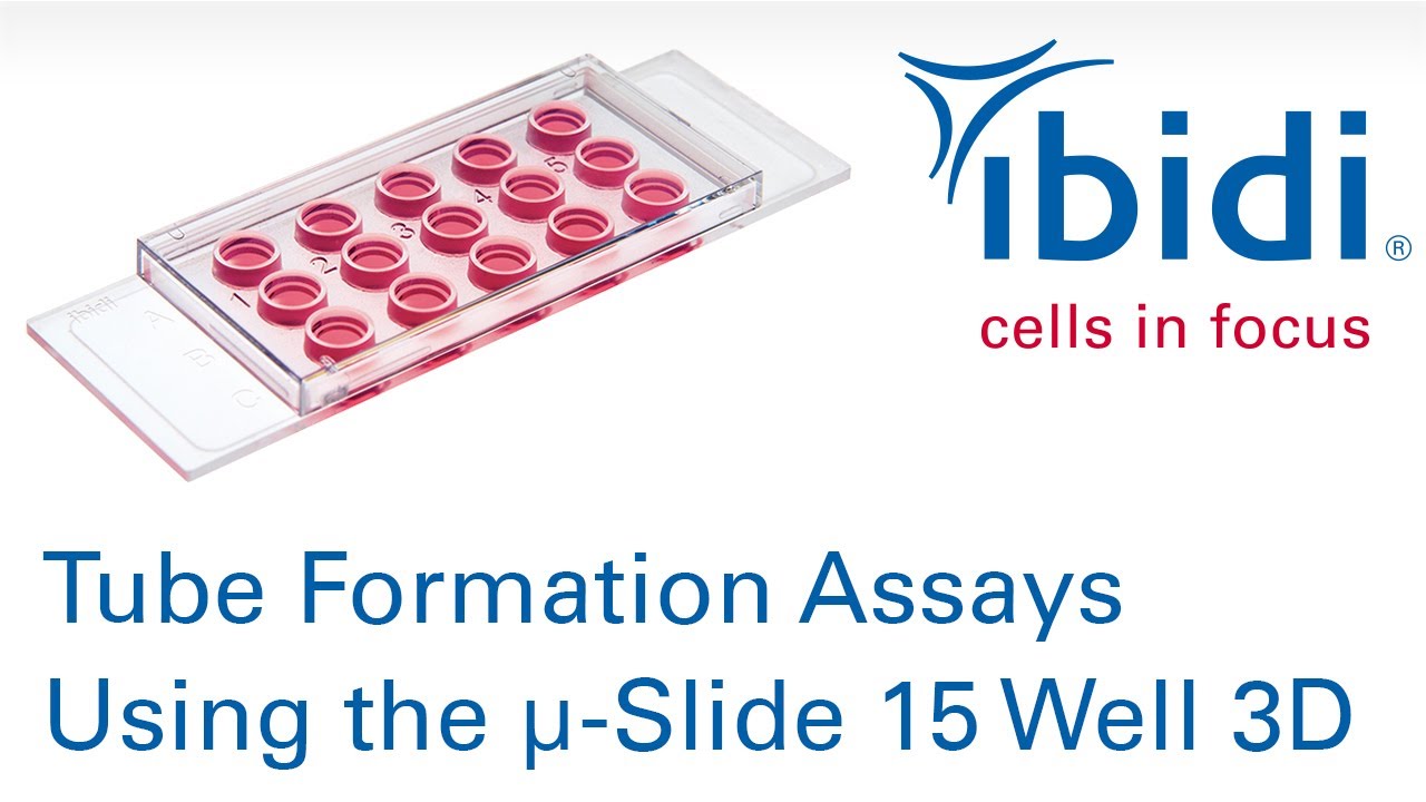 Tube Formation Assays Using the µ-Slide 15 Well 3D