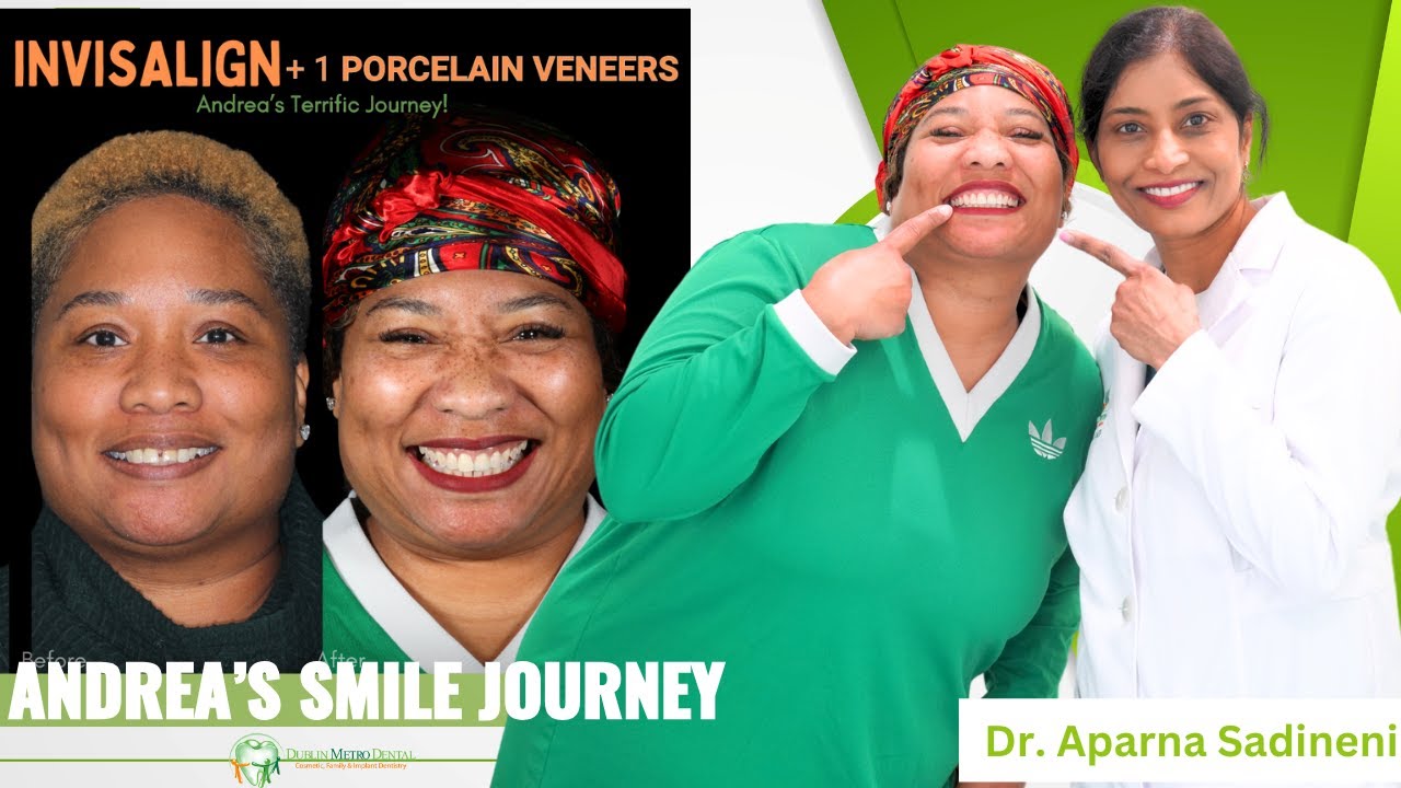From Gap to Grin Andrea's Smile Transformation Journey | Dr. Sadineni | Dublin Metro Dental