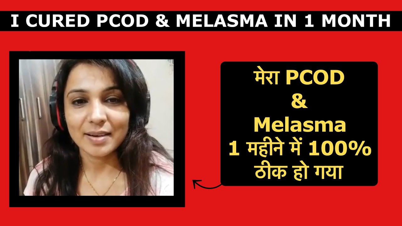 I cured my PCOD, Melasma/Pigmentation in just 1 month. मेरी झाइयाँ ओर PCOD 30 दिनों में चली गयी।