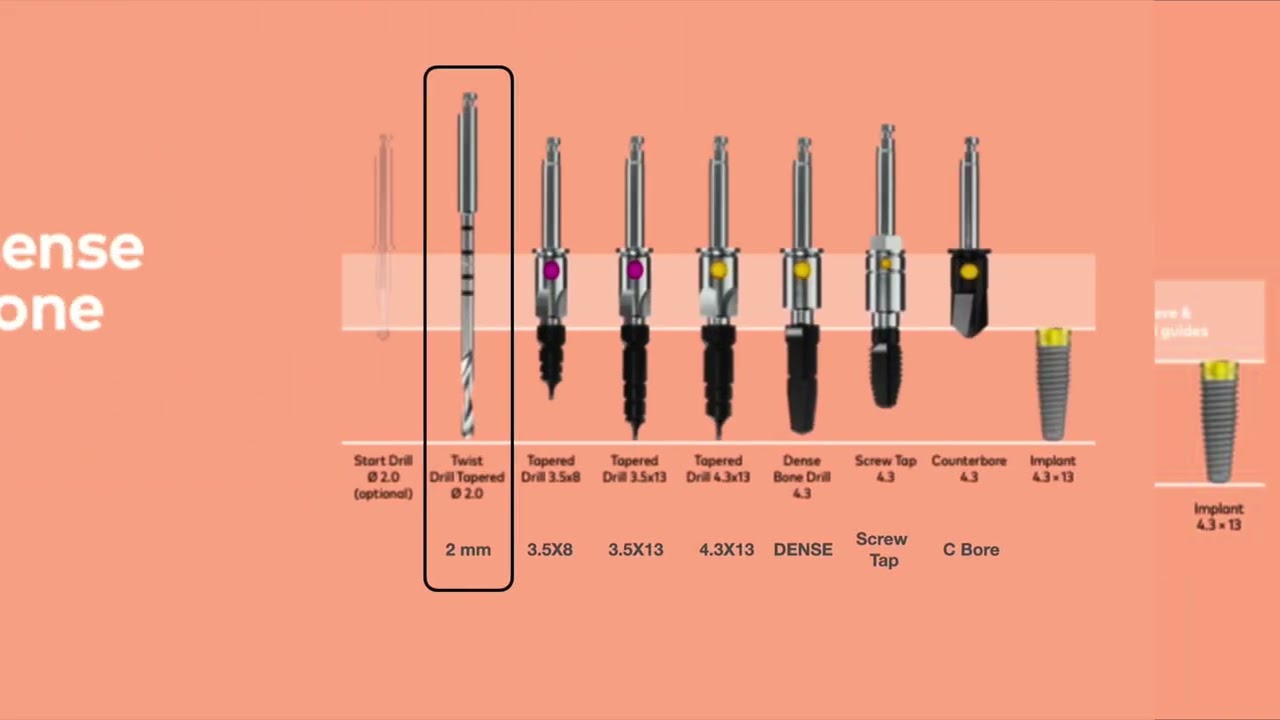 NobelReplace Protocol for NobelGuide Surgery - Maclean Education copyright 2025