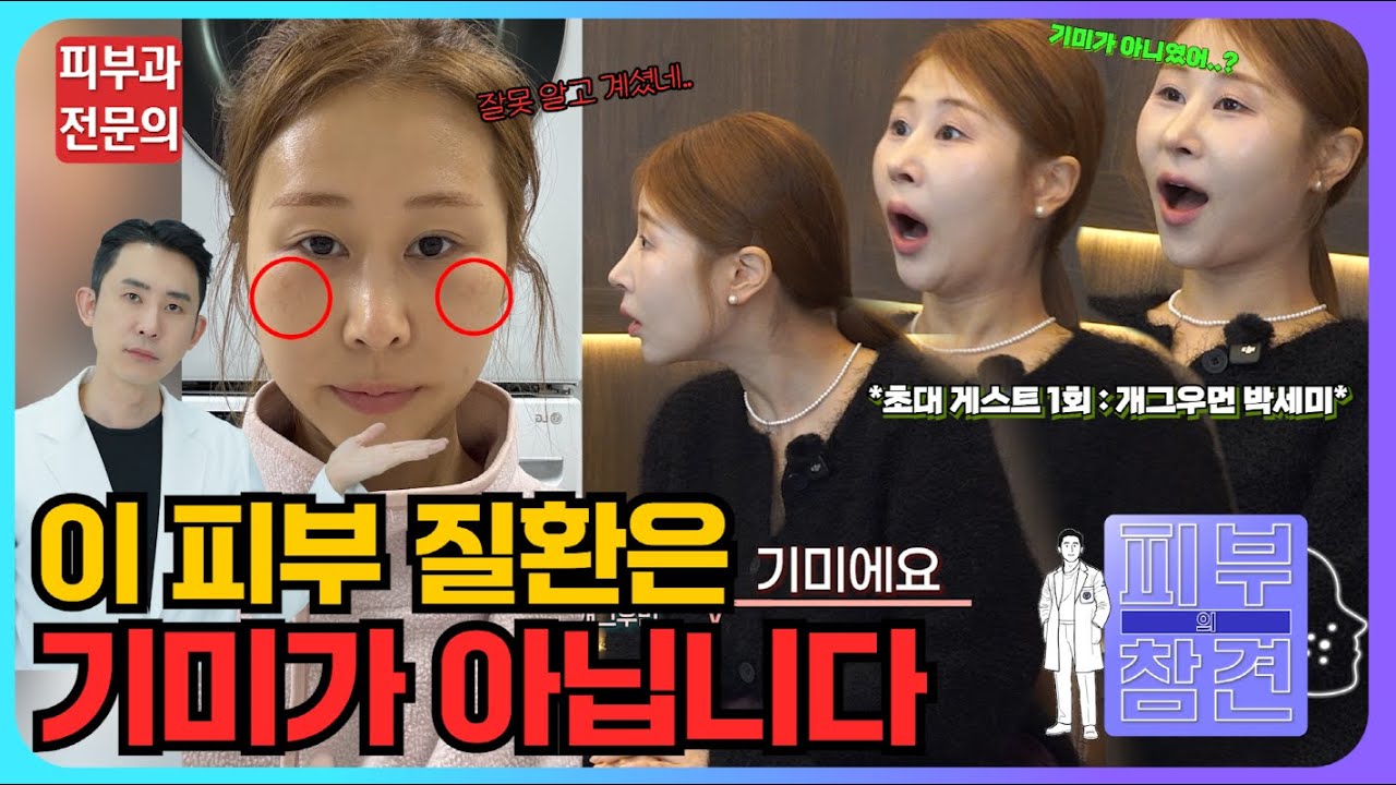 [피부심의 피부 참견] ep.1 박세미님, 그건 기미가 아닌데요?