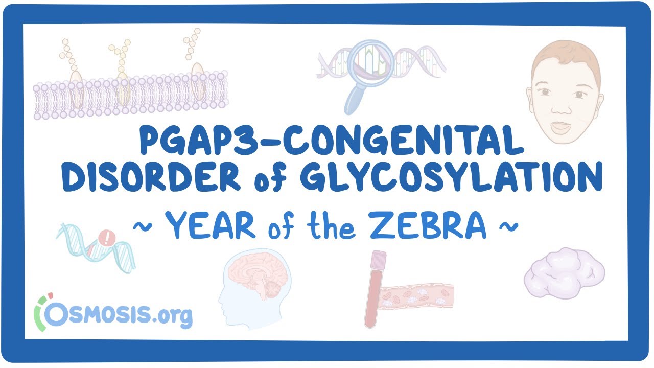 PGAP3-congenital disorder of glycosylation (Year of the Zebra)