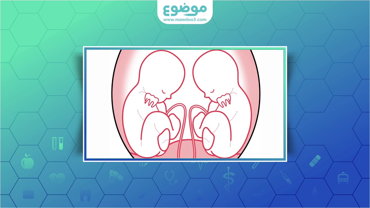 كيف اعرف اني حامل بتوأم؟