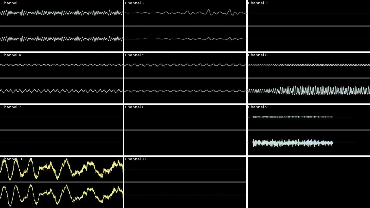 Pokémon - VS Kyurem (BW) - Oscilloscope View/Deconstruction