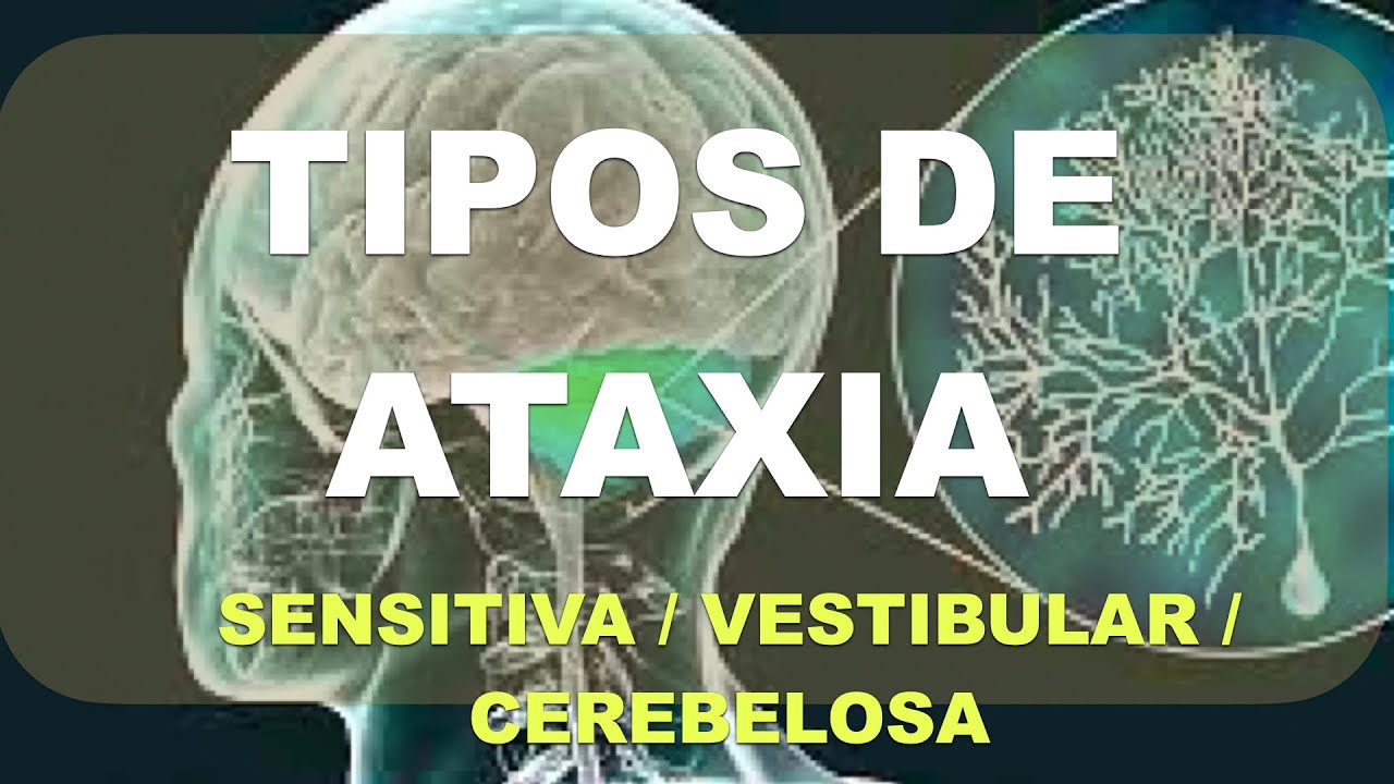 Ataxia, Diagnóstico Diferencial (Vestibular, Sensitivo, Cerebeloso)
