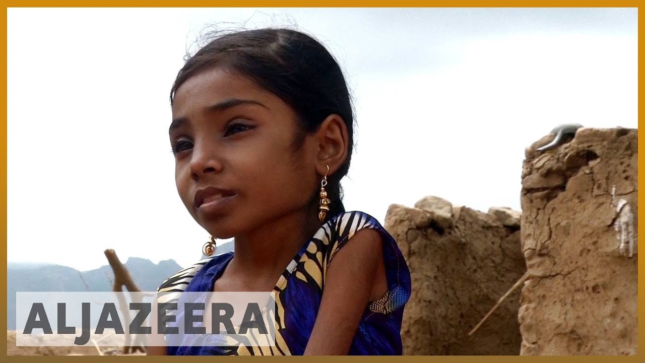 🇾🇪 10 years and 9 kilos: Child starvation takes its toll in Yemen l Al Jazeera English