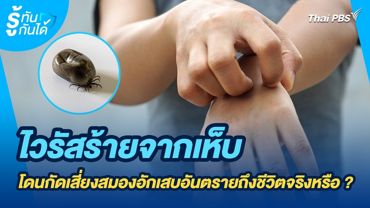 ไวรัสร้ายจากเห็บ โดนกัดเสี่ยงสมองอักเสบอันตรายถึงชีวิตจริงหรือ ? | รู้ทันกันได้ | วันใหม่วาไรตี้