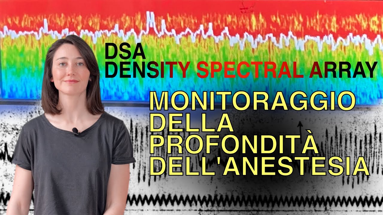 DSA, Density Spectral Array e monitoraggio della profondità dell'anestesia